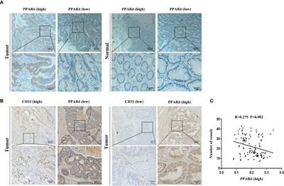 Knockdown of PPARδ Induces VEGFA-Mediated Angiogenesis via Interaction With ERO1A in Human Colorectal Cancer